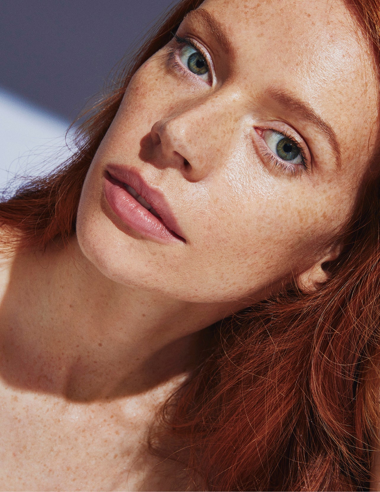 Vous souffrez d'hyperpigmentation ? Voici comment estomper les taches brunes post-éruption.